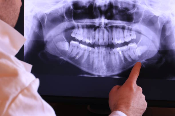 Best Emergency TMJ Treatment in Rochester Institute Of Technology, NY